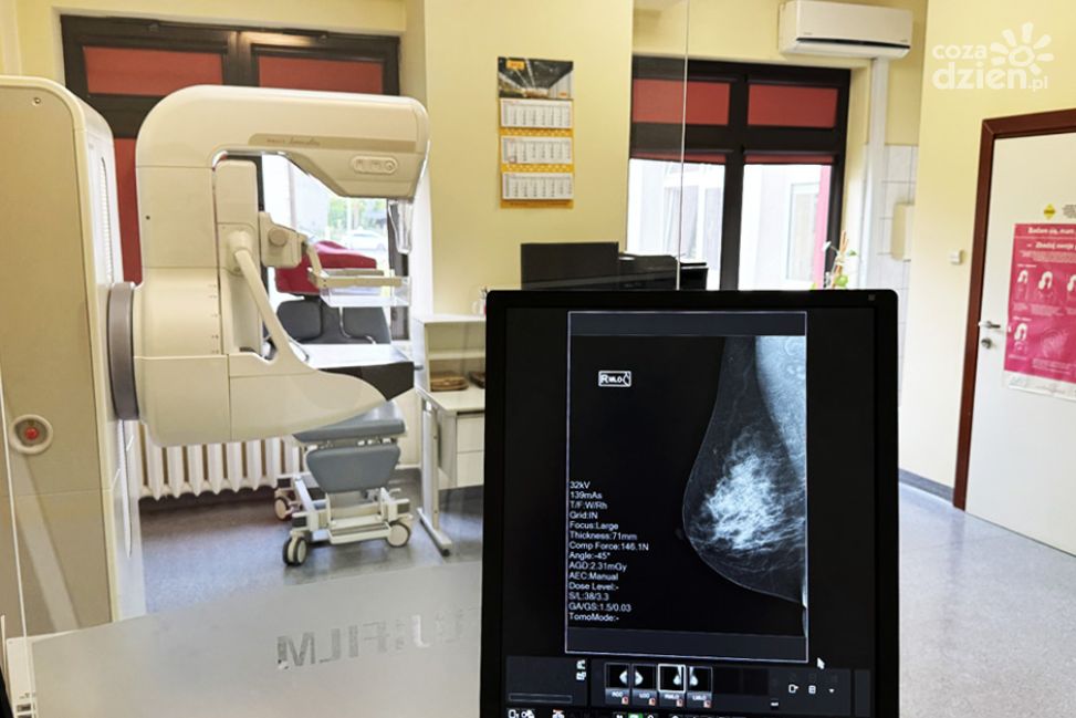 Tarnobrzeska Pracownia Mammografii stawia na precyzję, bezpieczeństwo i nowoczesną diagnostykę